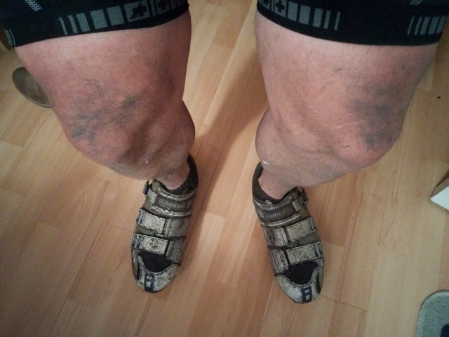 AAAnfractuous Dirty Legs AAAnfractuous Dirty Legs